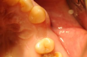 Dsc 1920 kwrwds - Eugenol