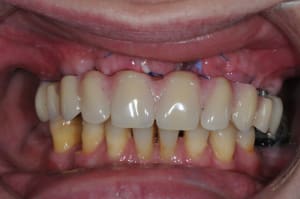 Dsc 1937 cakcno - Eugenol