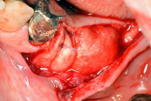 Dsc 2017 kvf5mh - Eugenol