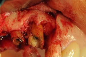 Dsc 2436 eze9gg - Eugenol