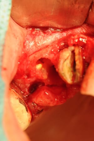 Dsc 2445 x4qd0p - Eugenol