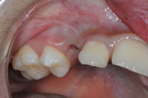 Dsc 2546 yynlse - Eugenol