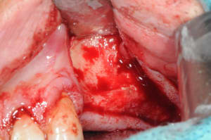 Dsc 2825 vkmlcp - Eugenol