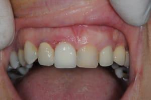 Dsc 3276 n3alb5 - Eugenol