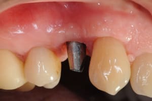 Dsc 3869 heusgo - Eugenol