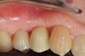Dsc 3873 aeqasj - Eugenol