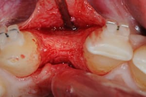Dsc 4054 e2y8al - Eugenol