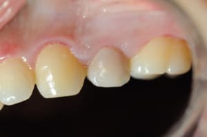 Dsc 4085 kv6j3j - Eugenol