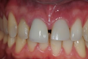 Dsc 4360 jdgw1p - Eugenol