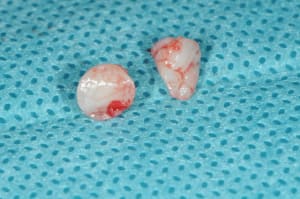 Dsc 4776 q2zes6 - Eugenol