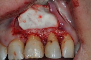 Dsc 5008 mamp8h - Eugenol