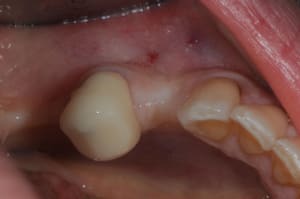 Dsc 5045 i17ral - Eugenol