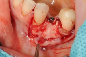 Dsc 5057 gimpib - Eugenol