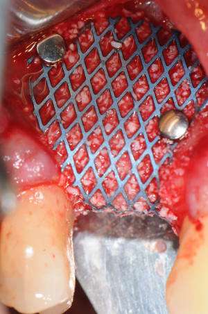 Dsc 5069 exrnla - Eugenol