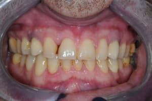 Dsc 5327 wbzmi9 - Eugenol