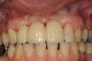 Dsc 5364 w17h2e - Eugenol