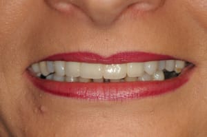Dsc 5493 nkzf5b - Eugenol
