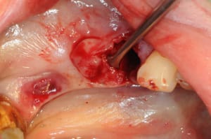 Dsc 5500 dspwi3 - Eugenol