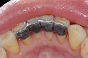 Dsc 5517 jesjg8 - Eugenol