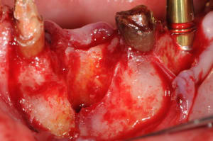 Dsc 5631 uvojsj - Eugenol
