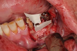 Dsc 5646 zxap47 - Eugenol