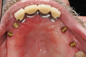 Dsc 5658 po18t8 - Eugenol