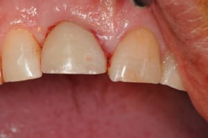Dsc 5780 mj04ib - Eugenol