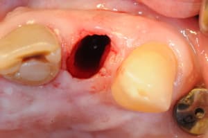 Dsc 5854 kzxthm - Eugenol