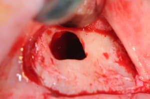 Dsc 5856 tzcgti - Eugenol