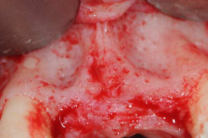 Dsc 5945 iwxsvh - Eugenol