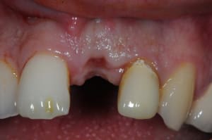 Dsc 5973 dfdcjj - Eugenol