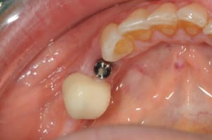 Dsc 6230 klym0j - Eugenol