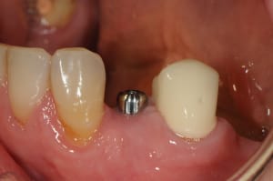 Dsc 6231 w4jjd4 - Eugenol