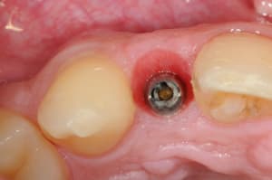 Dsc 6256 nxo42x - Eugenol