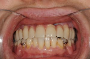 Dsc 6379 zhu8j3 - Eugenol