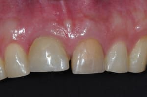 Dsc 6985 ewx1nm - Eugenol
