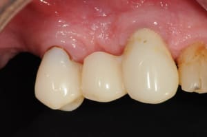 Dsc 7606 ghqwf2 - Eugenol