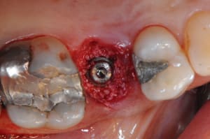 Dsc 7936 xh3ng3 - Eugenol