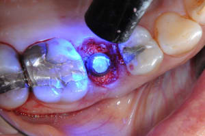 Dsc 7938 ta7zqr - Eugenol