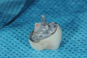 Dsc 7941 dtaq0h - Eugenol