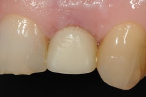 Dsc 8007 jytddc - Eugenol