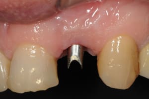Dsc 8009 q4spsu - Eugenol