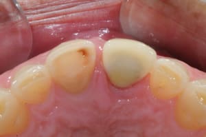 Dsc 8380 rppagt - Eugenol