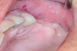 Dsc 9738 uzwrds - Eugenol