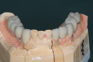 Dsc 9964 vww4ro - Eugenol