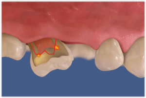 Dentalmaster screenshot o5d0c8 - Eugenol