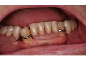 Diapositive1 vlhedk - Eugenol