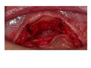 Diapositive4 lqg3t5 - Eugenol