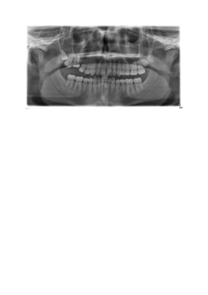 Doc1 r2ngpm - Eugenol