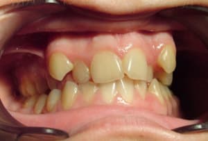 Dscf0971 pqrdam - Eugenol